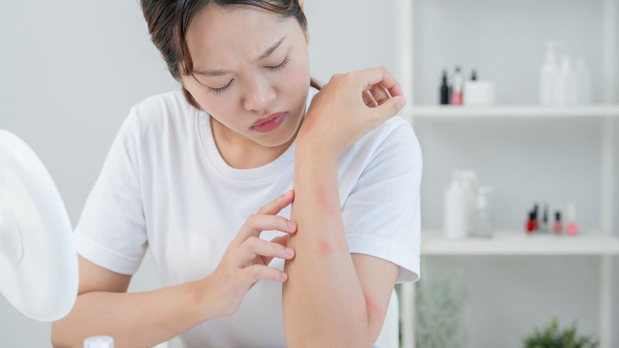 Rekomendasi Body Lotion untuk Kulit Kering, Apa yang Tepat?